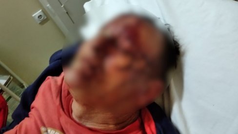 HOROR KOD MALOG ZVORNIKA: Tri muškarca brutalno pretukla Mlađa Tomića, nesrećni čovek u teškom stanju (UZNEMIRUJUĆI FOTO) HOROR KOD MALOG ZVORNIKA: Tri muškarca brutalno pretukla Mlađa Tomića, nesrećni čovek u teškom stanju (UZNEMIRUJUĆI FOTO)