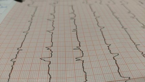 DOPLER KAROTIDE I EKG: Besptani pregledi u subotu, prijavljivanje počelo danas