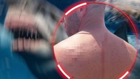 TO MI JE SPASILO ŽIVOT Muškarca napala i povredila ajkula, on bi je zagrlio - neverovatna priča iz SAD (FOTO) TO MI JE SPASILO ŽIVOT Muškarca napala i povredila ajkula, on bi je zagrlio - neverovatna priča iz SAD (FOTO)