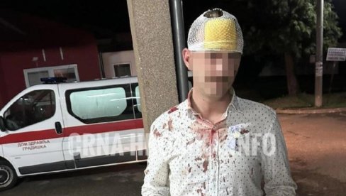 STEFAN RAZBIO GLAVU ZBOG ŠEMSINE PESME: Ima otvorene rane, a nalaz doktorke je hit na mrežama (FOTO) STEFAN RAZBIO GLAVU ZBOG ŠEMSINE PESME: Ima otvorene rane, a nalaz doktorke je hit na mrežama (FOTO)