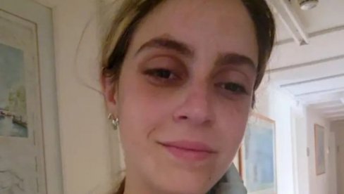 PUCALI SU MI U NOGE, NE VERUJEM DA ĆU USPETI Ona je poslednje sate života provela spasavajući ranjene u Izraelu PUCALI SU MI U NOGE, NE VERUJEM DA ĆU USPETI Ona je poslednje sate života provela spasavajući ranjene u Izraelu