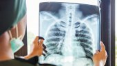 SKRINING NA RANO OTKRIVANJE RAKA PLUĆA: Prošlo više od 2.200 građana u riziku