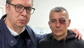 BOLJŠEVIČKI PLENUMAŠI UDARILI SU GA U OKO ISPRED: Vučić obišao povređenog policajca