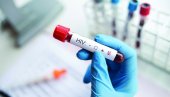 NEMERLJIV=NEZARAZAN: Istina o HIV koju svi treba da znaju