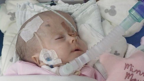 ЗА НИКОЛИЈУ СВАКИ УДАХ ВЕЛИКА БОРБА: Осмомесечна девојчица из Силбаша има тежак генетски поремећај, за кућно лечење треба 1.500 евра месечно