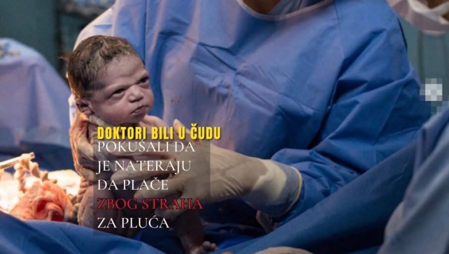 О БЕСНОЈ БЕБИ ПРИЧАО СВЕТ - ВИДИТЕ ЈЕ САД: Доктори били у чуду - покушали да је расплачу, да виде раде ли јој плућа (ФОТО) О БЕСНОЈ БЕБИ ПРИЧАО СВЕТ - ВИДИТЕ ЈЕ САД: Доктори били у чуду - покушали да је расплачу, да виде раде ли јој плућа (ФОТО)