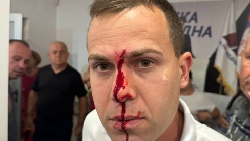 БЛОКАДЕРИ ЧОВЕКУ РАСКРВАРИЛИ ГЛАВУ: Језиво насиље у Лазаревцу (ФОТО)