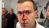 БЛОКАДЕРИ ЧОВЕКУ РАСКРВАРИЛИ ГЛАВУ: Језиво насиље у Лазаревцу (ФОТО) БЛОКАДЕРИ ЧОВЕКУ РАСКРВАРИЛИ ГЛАВУ: Језиво насиље у Лазаревцу (ФОТО)