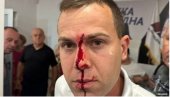 POVREĐENA TRI ČLANA SNS: Oglasio se Opštinski odbor u Lazarevcu povodom jezivog nasilja blokadera POVREĐENA TRI ČLANA SNS: Oglasio se Opštinski odbor u Lazarevcu povodom jezivog nasilja blokadera