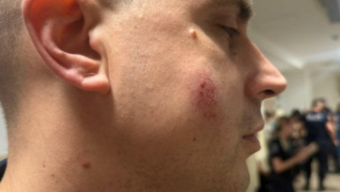 RASTE BROJ POVREĐENIH POLICAJCA U PANČEVU! Jedan gađan kamenom u glavu - jezivo (FOTO)