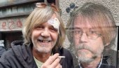 BARABA: Žika Todorović ostao bez prednjeg zuba, na glavi krvavi zavoji (FOTO)