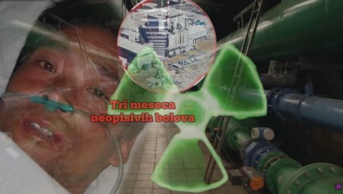 NAJBOLNIJA SMRT U ISTORIJI: Plakao krv posle nuklearne katastrofe, molio doktore da ga puste da umre - TRI MESECA agonije NAJBOLNIJA SMRT U ISTORIJI: Plakao krv posle nuklearne katastrofe, molio doktore da ga puste da umre - TRI MESECA agonije