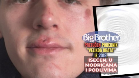 BRUTALNO PRETUČEN POBEDNIK VELIKOG BRATA Politika, vlada, ljudi — žele da nas podele, ali oni neće pobediti BRUTALNO PRETUČEN POBEDNIK VELIKOG BRATA Politika, vlada, ljudi — žele da nas podele, ali oni neće pobediti