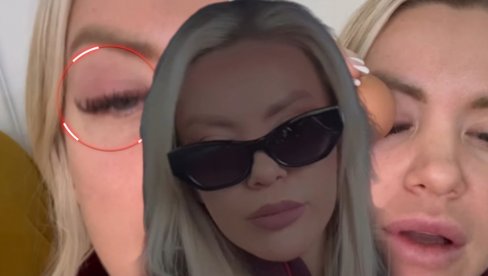 VODITELJKI ZATVORENO OKO: Baš je strašno, baš me boli (FOTO)