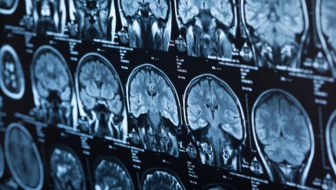 SRPSKI AS DOŽIVEO POTRES MOZGA! Ni trener ne zna kada će moći na teren