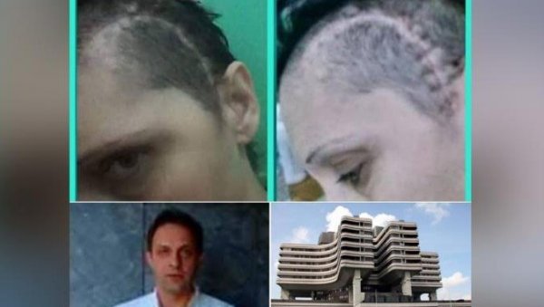 ПОРУКА ЈЕДНЕ РУЖИЦЕ НАКОН ПРЕЖИВЉЕНОГ ПАКЛА: Доживела мождани удар, није знала ко је, а сада поделила своју причу