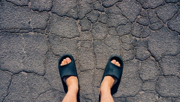 ШТА ВАМ ТЕЛО ПОРУЧУЈЕ? Испуцале пете могу указивати на проблеме са штитном жлездом