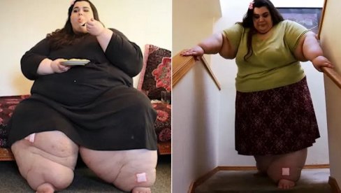 ИМАЛА СКОРО 300 КГ, НИЈЕ МОГЛА ДА ХОДА: Данас игледа сјајно - а на интенету је прати више од 400 хиљада људи! (ФОТО)