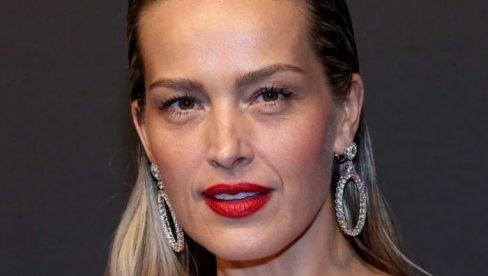 ТЕШКА СУДБИНА МЕНЕКЕНКЕ КОЈА ЈЕ ВЕРИНИКА ИЗГУБИЛА ПРЕД ПЧИМА: Осам сати чекала помоћ и поново учила да хода