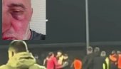 СКАНДАЛ ТРЕСЕ РЕГИОН! Фудбалери Жељезничара брутално претукли фотографа Слоге