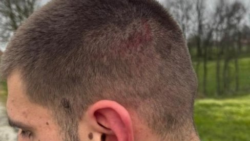 ПАЛИЦЕ, БИБЕР СПРЕЈ, МУНИЦИЈА... Приведени нападачи на Вукашина Ђоковића - Њих петнаесторица, ево шта су све имали код себе