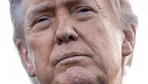 Лекар открио истину о Трамповом стању: Два проблема